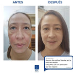 2X1 Tónico despigmentante MTC 100% efectivo + Obsequio Gratis 2 Bloqueador