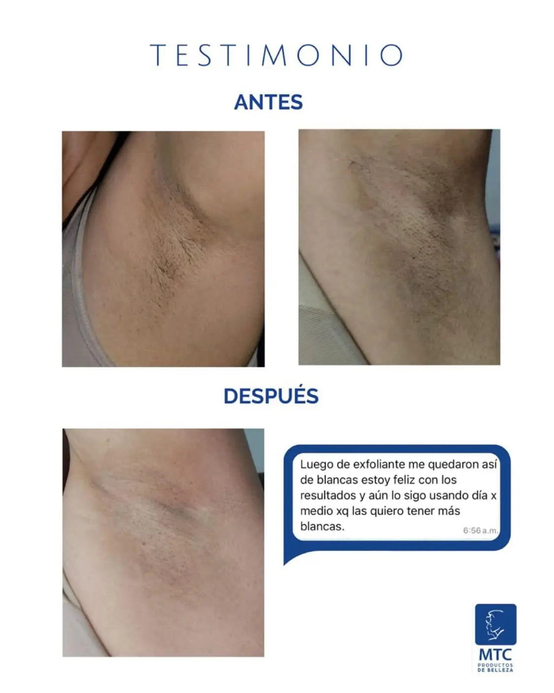 2X1 Tónico despigmentante MTC 100% efectivo + Obsequio Gratis 2 Bloqueador