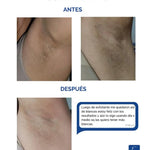 2X1 Tónico despigmentante MTC 100% efectivo + Obsequio Gratis 2 Bloqueador