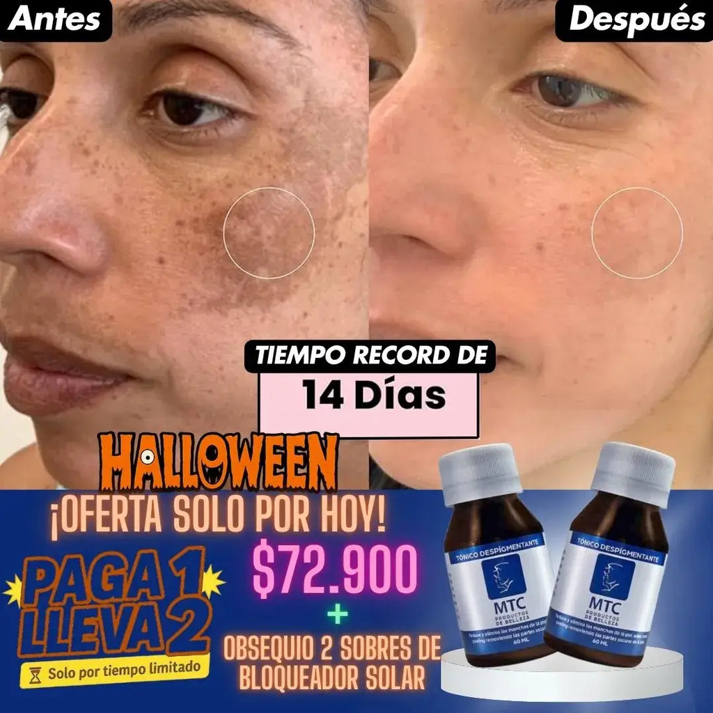 Adiós Manchas en 14 Días con el Tónico despigmentante MTC + Obsequio 1 sobre Bloqueador